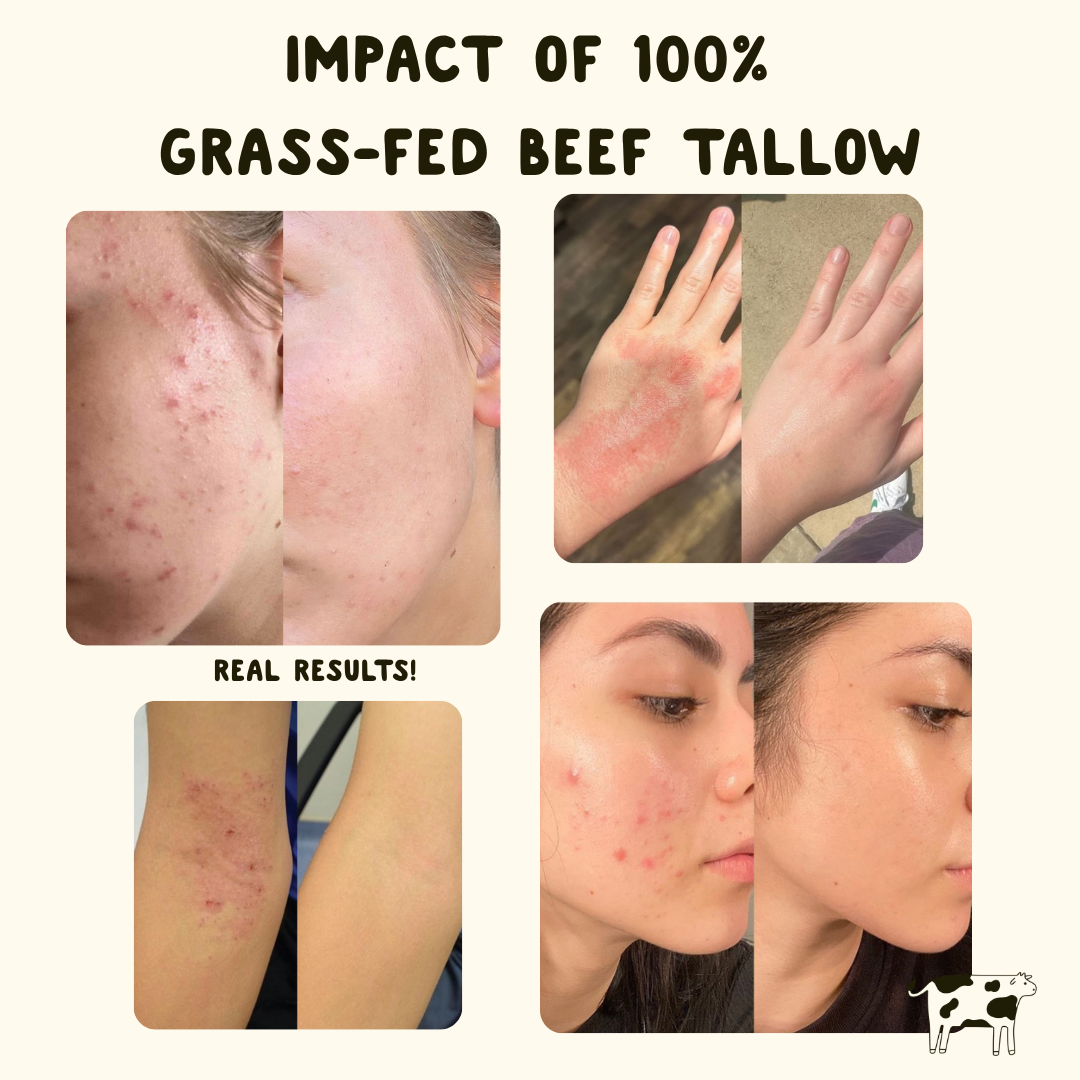 Revitalizing Tallow Cream