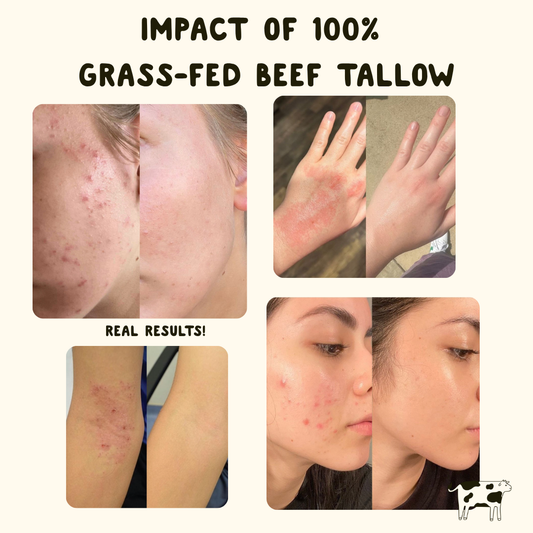 Revitalizing Tallow Cream